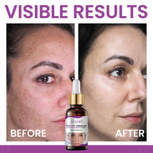 Load image into Gallery viewer, Melanix Advanced Brightening Serum | Dark Spot Corrector & Skin Tone Repair | Fade Pigmentation & Boost Radiance (30ml)