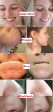 Load image into Gallery viewer, Green Tea Nourishing Clay Stick Mask | Deep Pore Cleansing, Hydrating &amp; Gentle Exfoliation (40g)
