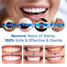 Load image into Gallery viewer, Teeth Whitening Pen | Gentle Stain Remover &amp; Enamel-Safe Brightening Formula | Portable Instant White Smile (4ml)