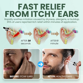 NESELMY™ Daily Ear Refresh Drops | Natural Botanical Formula | Relieves Itchiness, Cleanses & Hydrates Ears (20ml)
