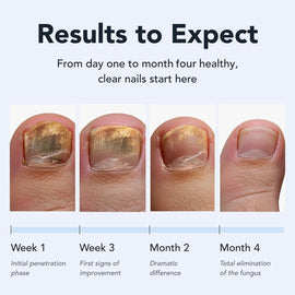 JUJIK Nail Repair Pen | Botanical Anti-Fungal Formula for Restoring Healthy, Smooth, and Shiny Nails (3ml)